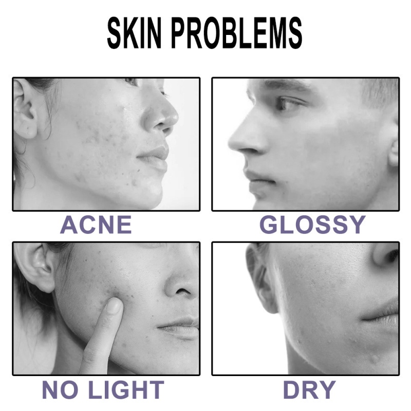 (Hàng Mới Về)Mặt Nạ Bùn Trà Xanh Kiềm Dầu Dưỡng Ẩm Loại Bỏ Mụn Đầu Đen Se Khít Lỗ Chân Lông Hiệu Quả UN | BigBuy360 - bigbuy360.vn