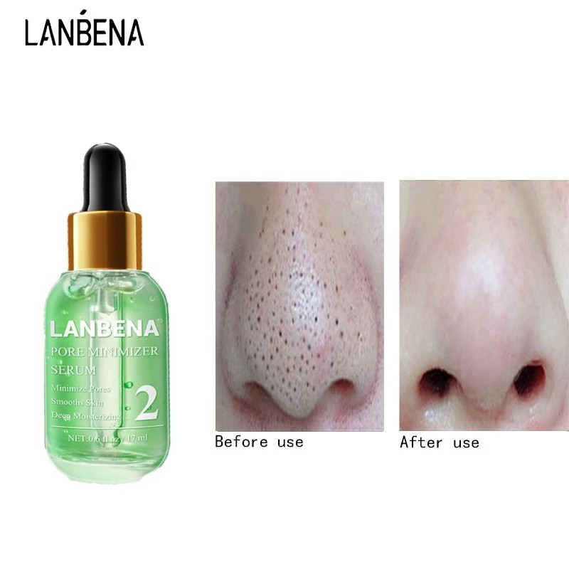 Tinh Chất Se Khít Lỗ Chân Lông LANBENA Dung Tích 17ml