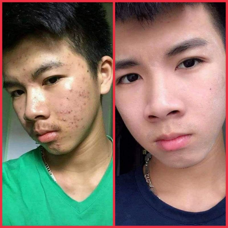 Đông Y Mộc Nhân Tái Tạo Da Thiên Nhiên Lọ 100ml