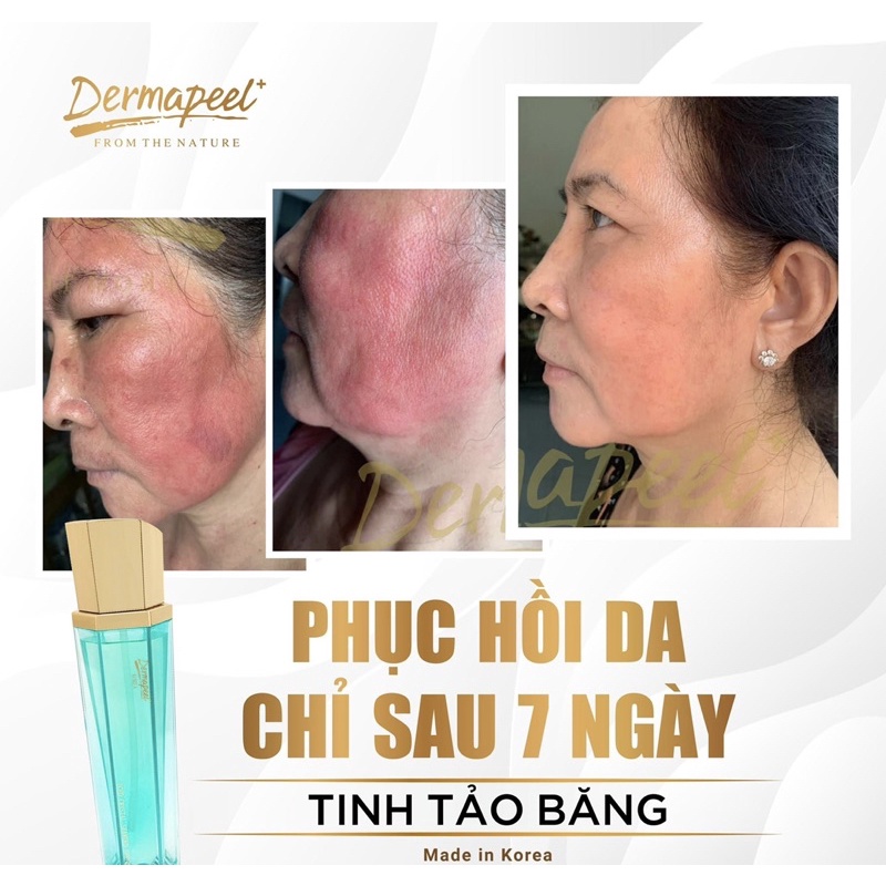 Tinh tảo băng Dermapeel 20ml