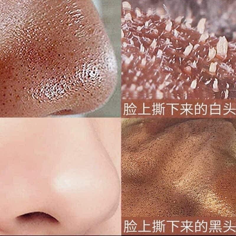 Gel Hút Mụn Dr acne