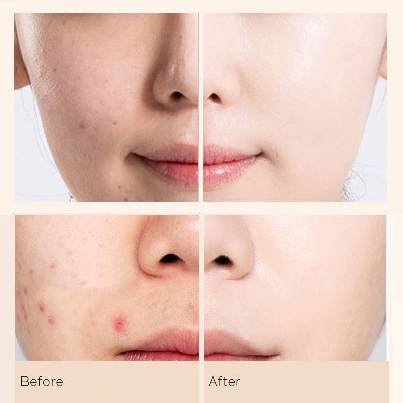 Kem che khuyết điểm dạng lỏng LAMEILA che phủ quầng thâm mắt hiệu quả | BigBuy360 - bigbuy360.vn