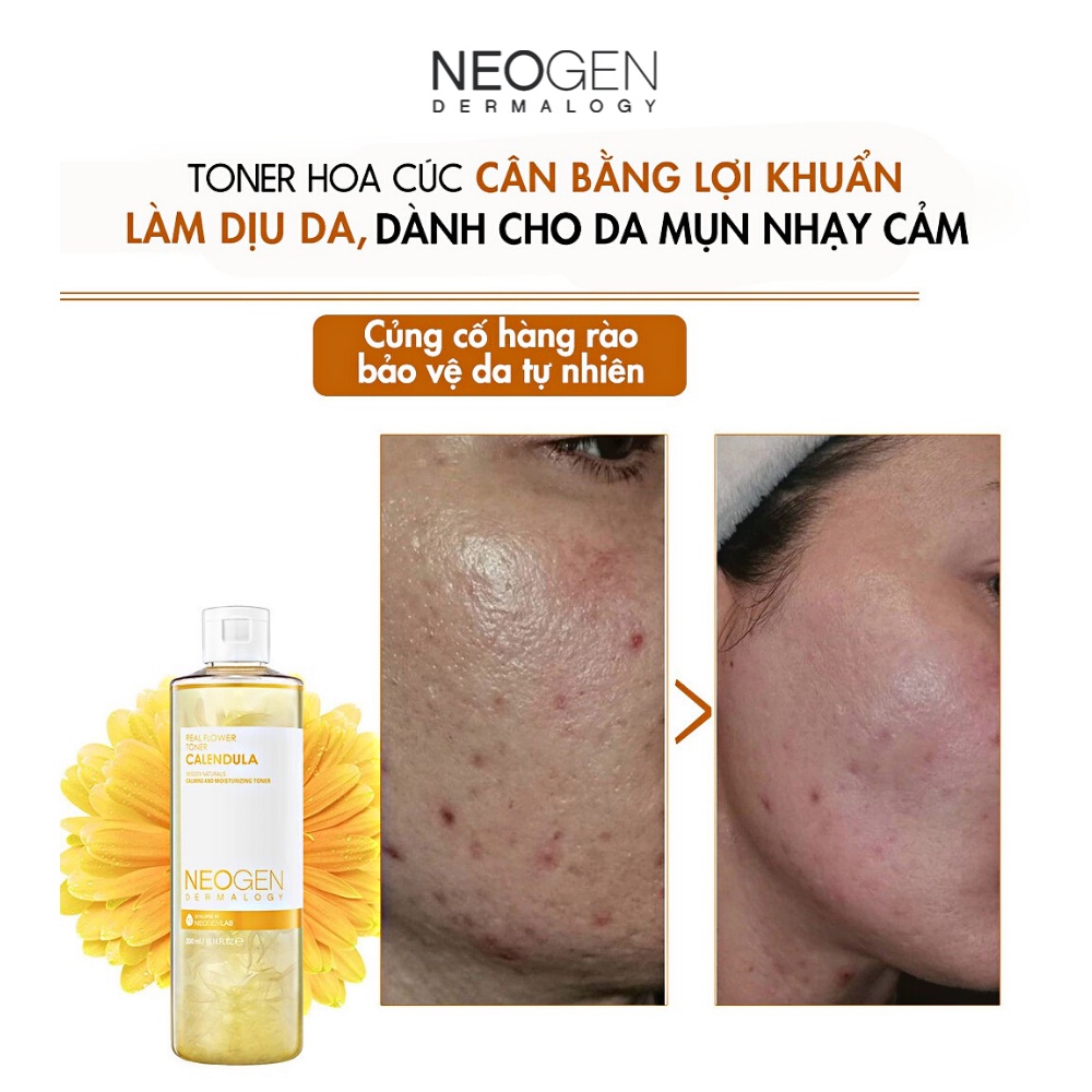 Nước Hoa Hồng Chiết Xuất Hoa Cúc Siêu Cấp Ẩm Dịu Da Cho Da Mụn Neogen Dermalogy Real Flower Calendula Toner 300ml