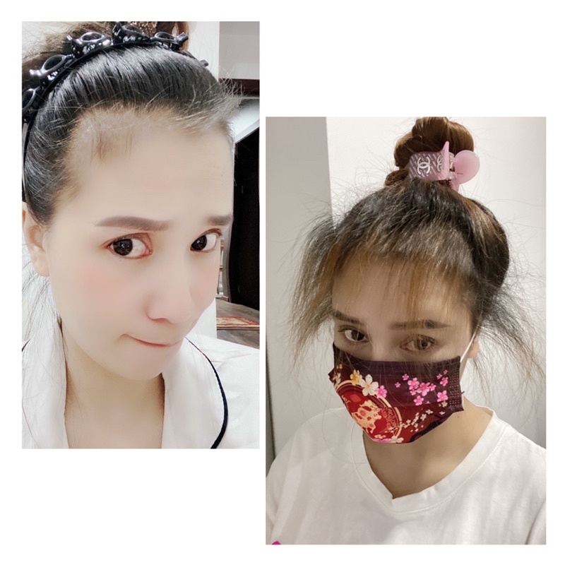 Dầu Ủ Oil Treatment Mọc Tóc mẫu cũ 150mil