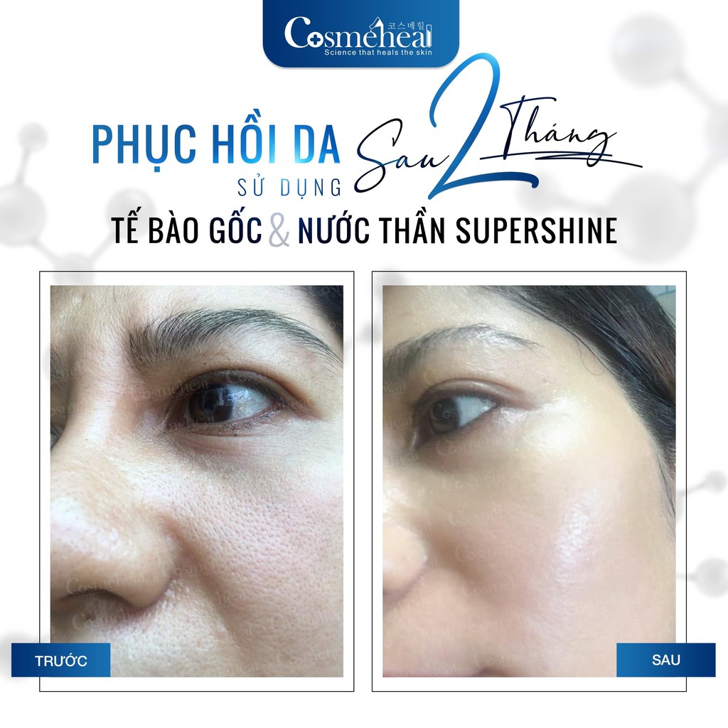 [HÀNG NHẬP KHẨU] Tế Bào Gốc Phục Hồi Căng Bóng Da, Giảm Nhăn, Cấp Ẩm Cosmeheal Supershine Ampoule