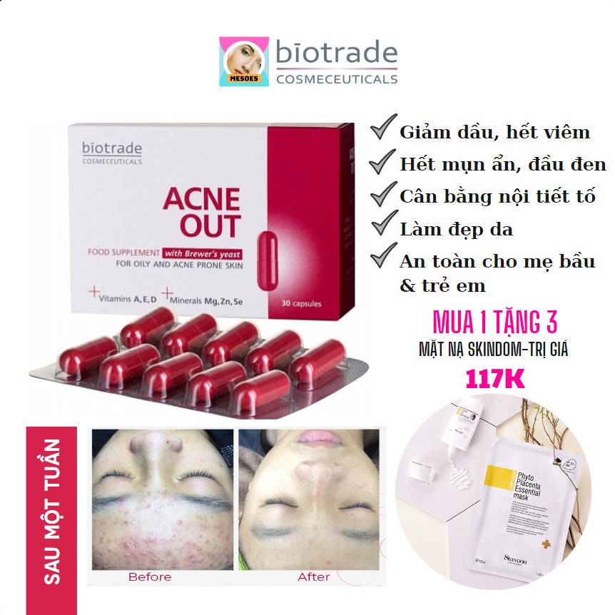 Viên uống giảm mụn Biotrade Acnaut Food Supplement 30 viên, đẹp da, giảm thâm mụn - Bác Sĩ Phương Trang