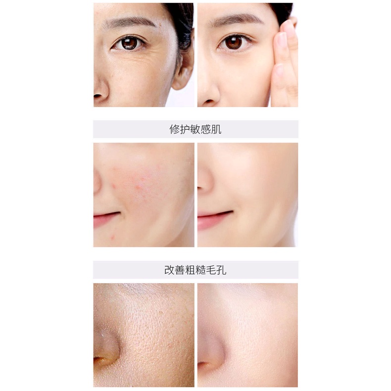 1 Hộp Chiết Xuất Chanh Fullerene Placenta Làm Săn Chắc Sáng Da Chống Nếp Nhăn Tinh Chất Dưỡng Ẩm Làm Sáng Da Chống Nếp Nhăn Tiện Dụng