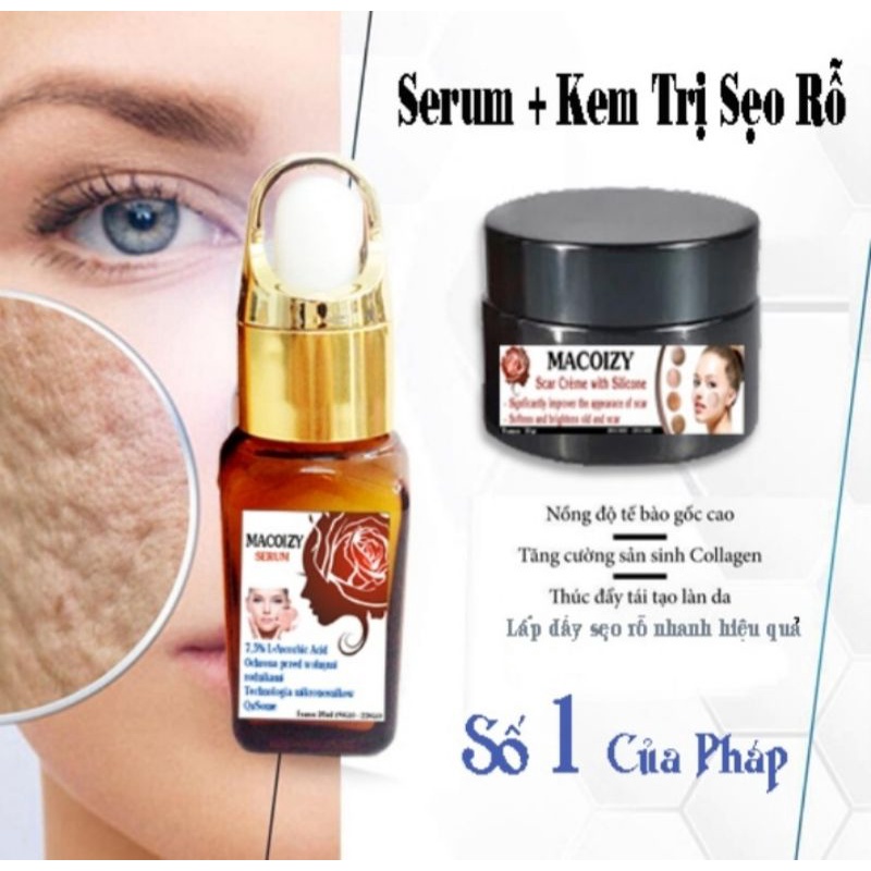Combo serum Macoizy & Kem Xóa Sẹo rỗ