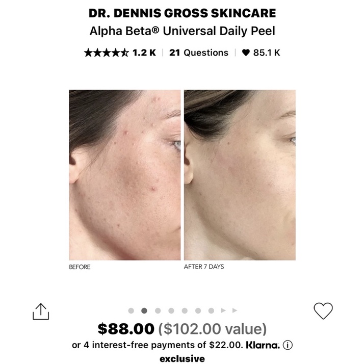 Set 3 khăn giấy peel da Dr Dennis Gross Alpha Beta® Universal Daily