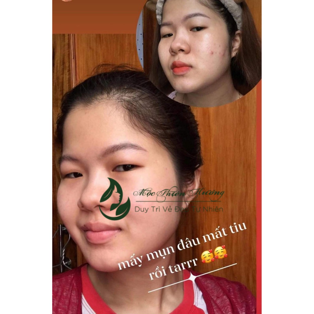 Serum giảm mụn thâm rỗ, sáng da, se khít lỗ chân lông Mộc Thiên Hương 50ml | BigBuy360 - bigbuy360.vn