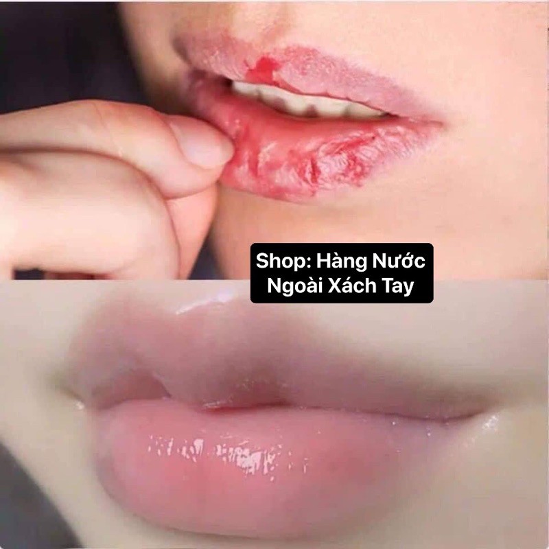 SON DƯỠNG HỒNG MÔI,KHỬ THÂM,KHÔ MÔI THÁI LAN