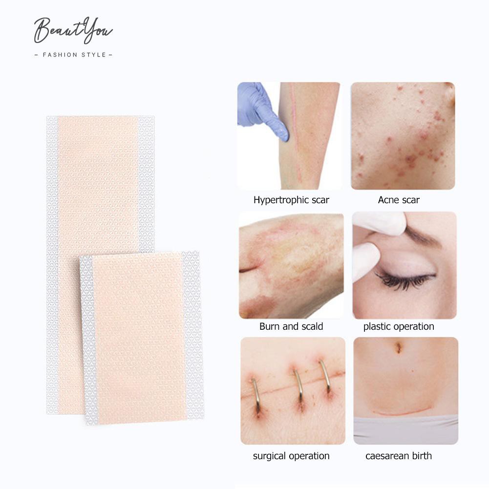 (Hàng Mới Về) Miếng Dán Che Khuyết Điểm Sẹo Mụn Vô Hình Bằng Silicone | BigBuy360 - bigbuy360.vn