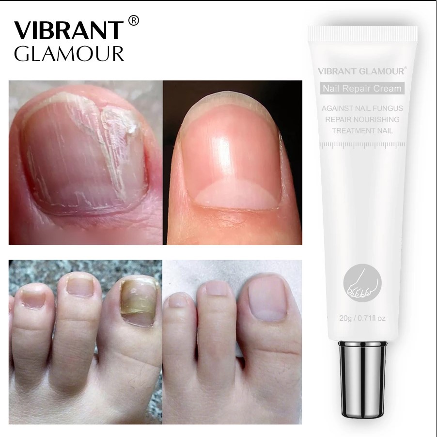 VIBRANT GLAMOUR Kem Dưỡng Móng Phục Hồi Móng Nấm - Móng Hư Tổn
