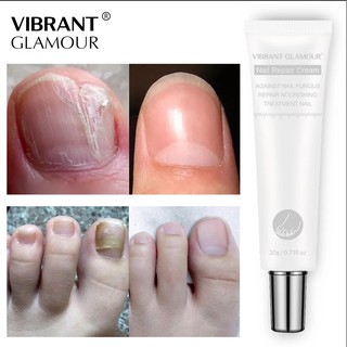 Vibrant glamour kem dưỡng móng phục hồi móng nấm - móng hư tổn