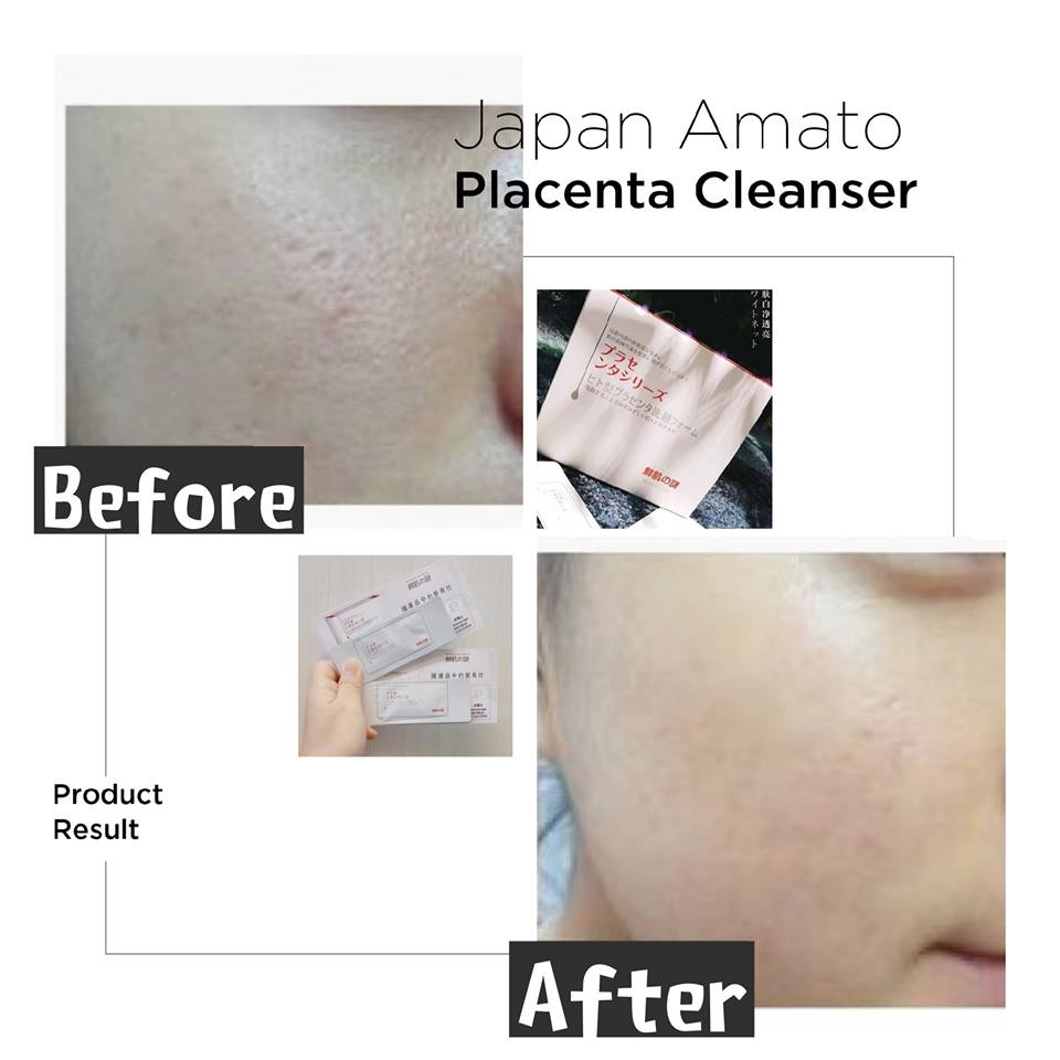 Mặt Nạ Ủ Trắng Da Rwine Beauty Placenta Face Cleanser