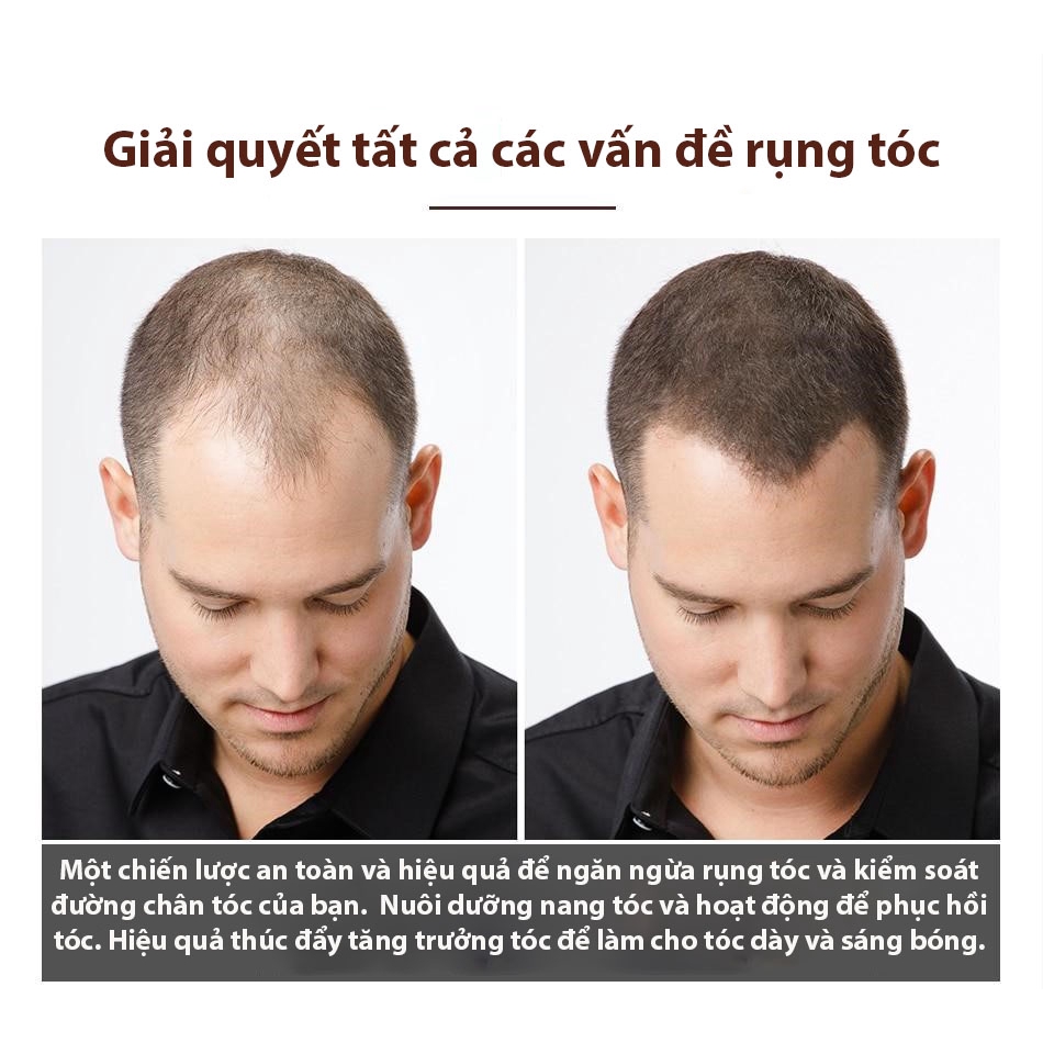 VIBRANT GLAMOUR Tinh Chất Kích Thích Mọc Tóc Giảm Gãy Rụng Chống Hói 30ml