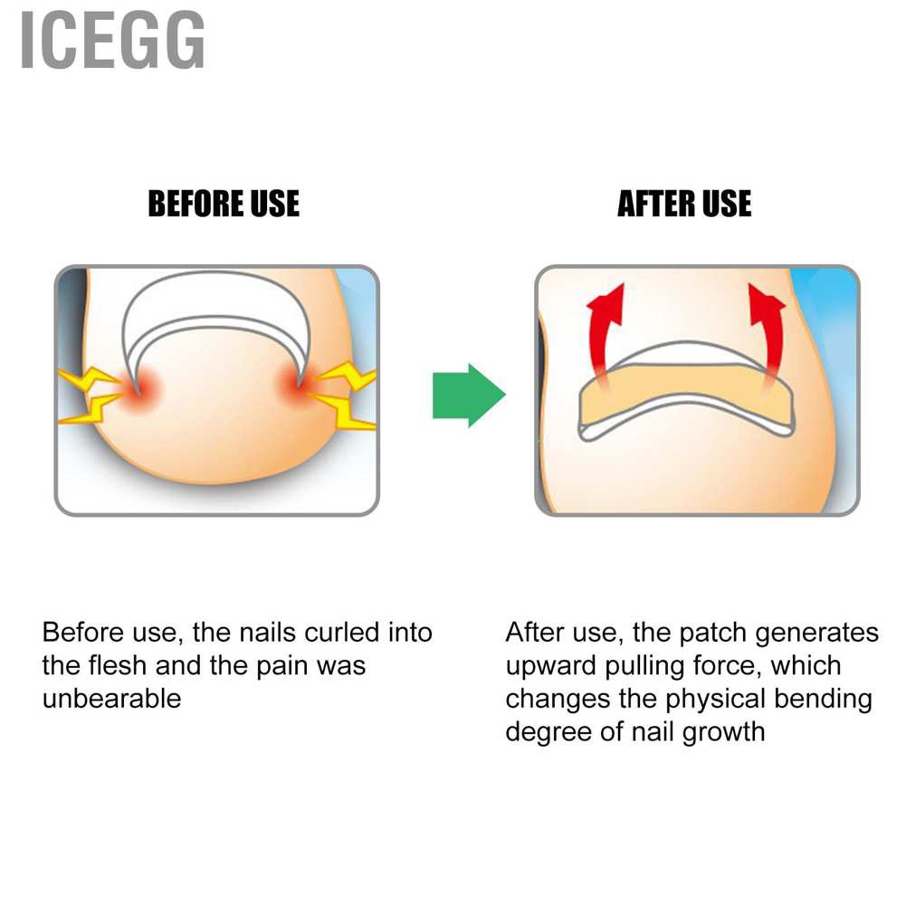 (Hàng Mới Về) Set 13 Dụng Cụ Chỉnh Hình Móng Chân Mọc Ngược Tiện Dụng | BigBuy360 - bigbuy360.vn