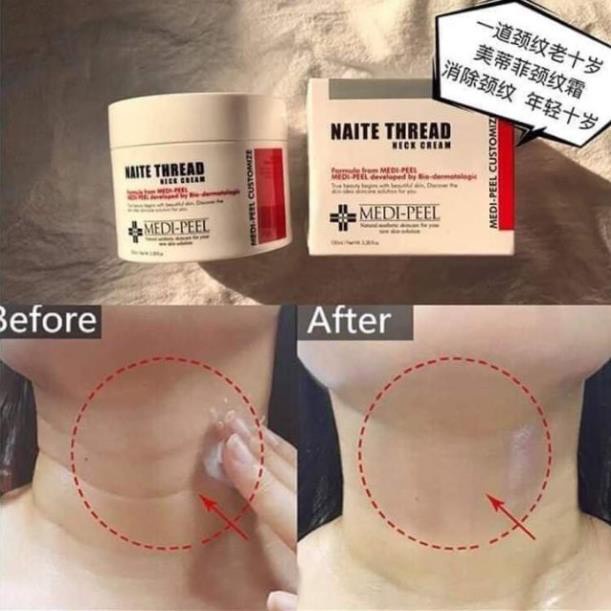 Kem Chống Lão Hóa Vùng Cổ Medi-Peel Naite Thread, giúp da cổ mềm mại, giảm nếp nhăn [ CHÍNH HÃNG ]