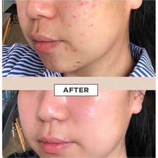 [HÀNG CTY CÓ TEM VAT] Bộ dưỡng da rau má Centella - ALISA