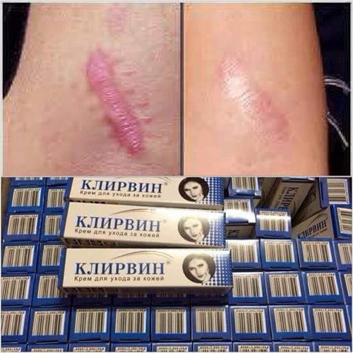 FREESHIP Kem sẹo, mờ rạn da, sẹo lồi sẹo do phẫu thuật mờ sẹo lâu năm 25g