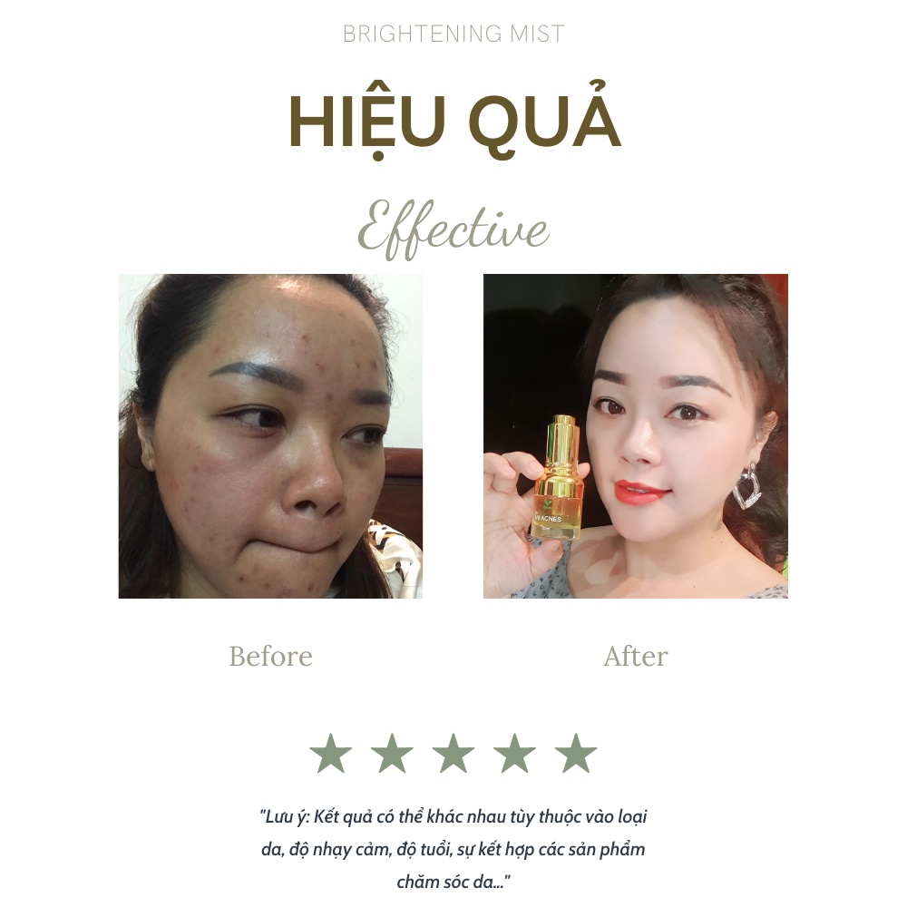 Serum giảm mụn V9Queen, tinh chất rau má dưỡng trắng da mờ thâm - Dr V9 Acnes 20ml