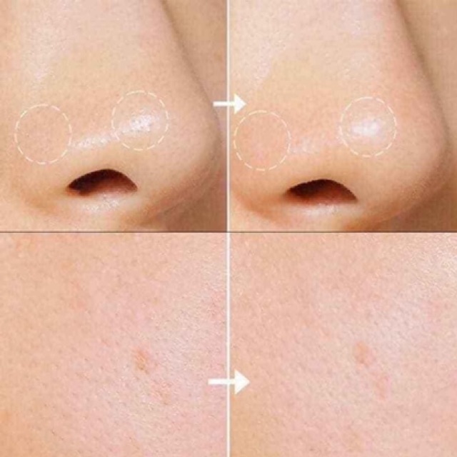  [Mini] Nước Hoa Hồng Toner Hoa Cúc kiehl’s Celendula 40ml | BigBuy360 - bigbuy360.vn