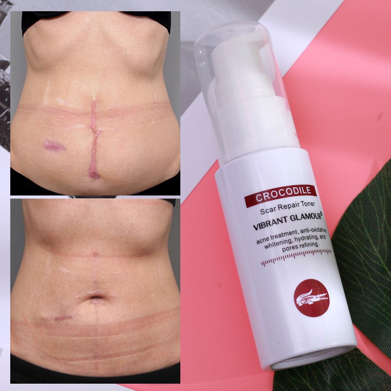 Toner VIBRANT GLAMOUR hỗ trợ giảm sẹo do mụn giảm vết rạn da cấp ẩm không gây nhờn dính phù hợp với mọi loại da 40ml | BigBuy360 - bigbuy360.vn