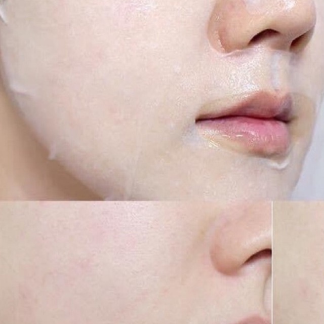 MẶT NẠ BANOBAGI VITAMIN MASK MẪU MỚI 2022