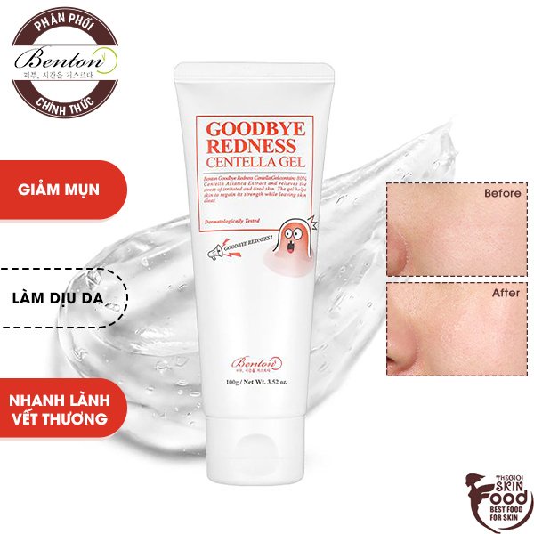 Gel Dưỡng Chăm Sóc Da Mụn, Làm Dịu Da Chiết Xuất Rau Má Benton Goodbye Redness Centella Gel 100g