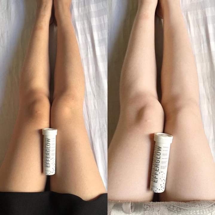 Sủi Trắng Da Cosmeheal Healthy White Efferglow, Viên Uống Trắng Da Hàn Quốc Giúp Bổ Sung Collagen Dưỡng Da Trắng Hồng