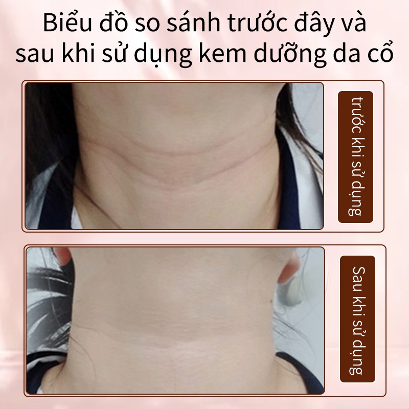 (Hàng Mới Về) Kem Dưỡng Da Cổ Làm Trắng Giảm Nếp Nhăn Dưỡng Ẩm 80g