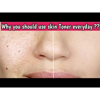Nước hoa hồng làm mềm da [comfort zone] Essential Toner
