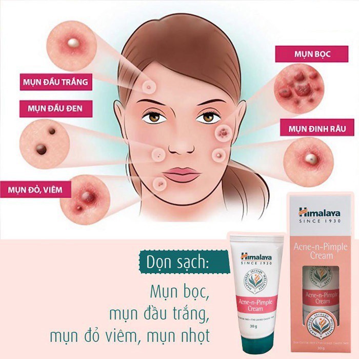 KEM GIẢM MỤN, MỜ THÂM, SE KHÍT LỖ CHÂN LÔNG HIMALAYA 30ML CHÍNH HÃNG - 8650