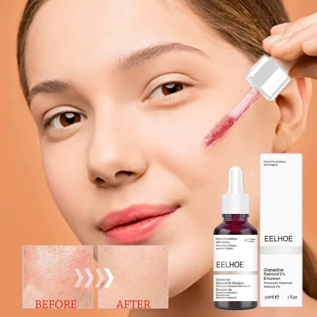 Tinh Chất Axit Salicylic Acid Trái Cây Tẩy Tế Bào Chết Dưỡng Ẩm Nuôi Dưỡng Da