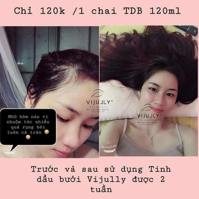 Combo 10 Chai Tinh Dầu Bưởi Vi Jully Vừa Dùng Vừa Bán