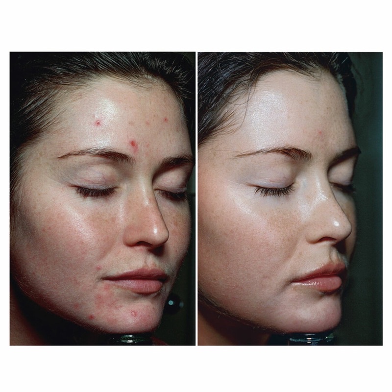 Khăn tẩy da chết SOMME INSTITUTE TRANSPORT Exfoliating Glycolic Acid fullsize 50 miếng