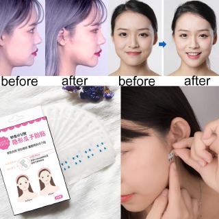 (hàng Mới Về) Set 40 / 80 Miếng Dán Nâng Cơ Mặt Tạo Cằm Chữ V Chống Nếp Nhăn