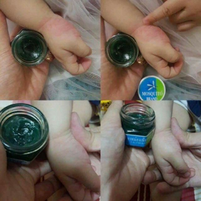 KEM BÔI CHỐNG MUỖI ĐỐT THÁI LAN (GREEN BALM MOSQUITO)