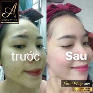 KEM FACE PHÁP A COSMETICS  trắng da,  sạch mụn