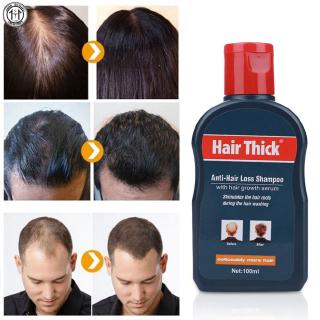 [Hàng mới về] Dầu gội kích thích mọc tóc nhanh 100ml