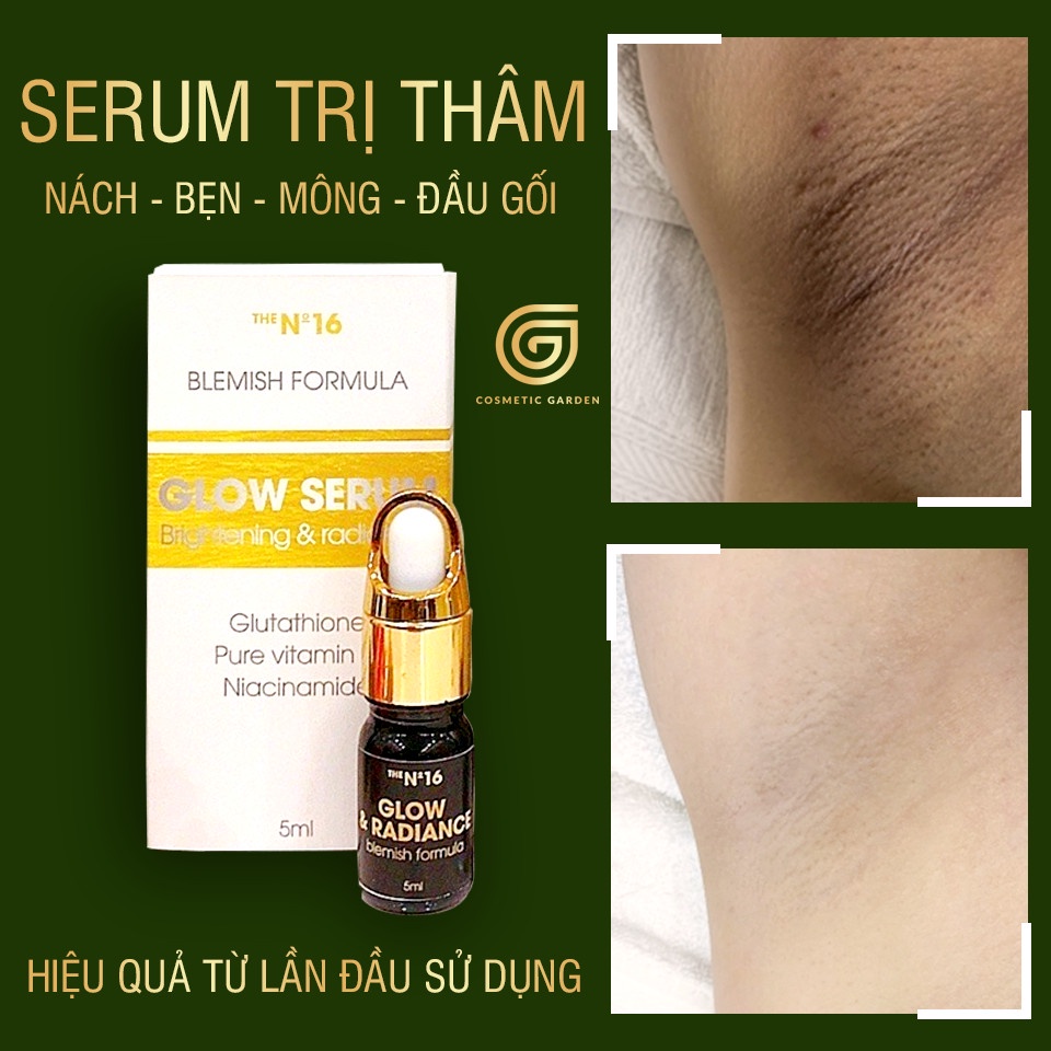Thâm đâu bôi đó hết thâm nách, thâm đầu gối, thâm mông