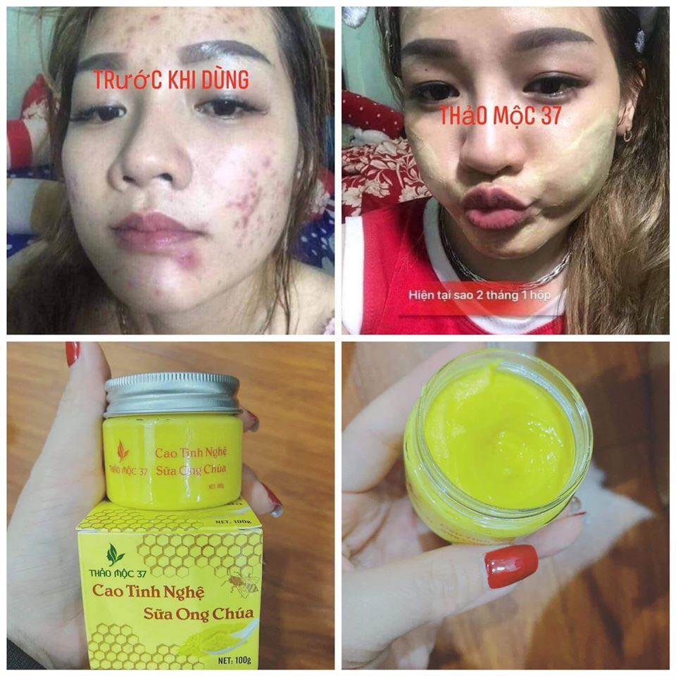 cao tinh nghệ sữa ong chúa thảo mộc 37  ngaysx 8.2019 | BigBuy360 - bigbuy360.vn