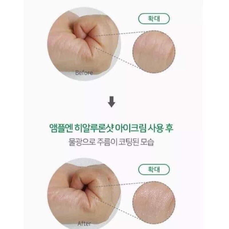 Kem Dưỡng Mắt Hyaluron Shot Ample:n Coreana | BigBuy360 - bigbuy360.vn