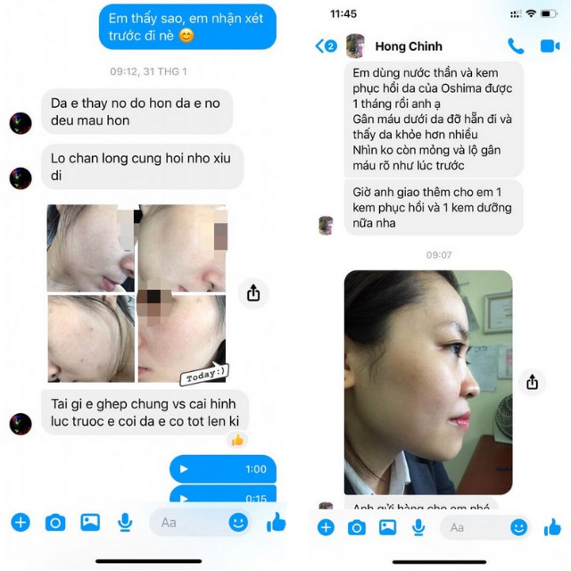 Xịt Khoáng Toner Dưỡng Ẩm, Dưỡng Trắng Da Mặt - Nước Hoa Hồng Se Khít Lỗ Chân Lông Giảm Mụn Ẩn Cho Da Dầu, Nhạy Cảm Khô | BigBuy360 - bigbuy360.vn