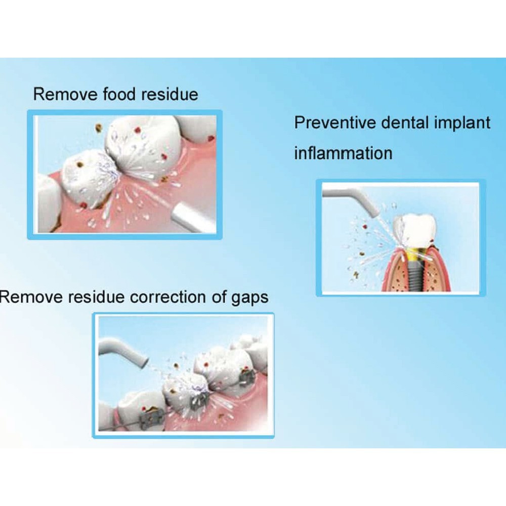 DỤNG CỤ VỆ SINH RĂNG MIỆNG POWER FLOSS CHÍNH HÃNG