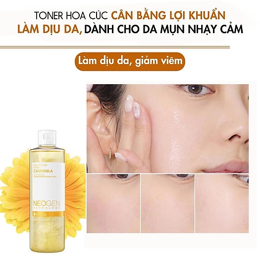 Nước Hoa Hồng Toner Hoa Cúc Cân Bằng Làm Dịu Da, Cấp Ẩm Cho Da Mụn Neogen Calendula 300ml