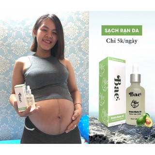 Tinh dầu chống rạn da Bae
