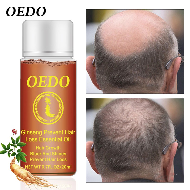 Dung dịch dưỡng tóc OEDO có thành phần nhân sâm ngăn ngừa rụng tóc giúp mọc và phục hồi tóc hư tổn