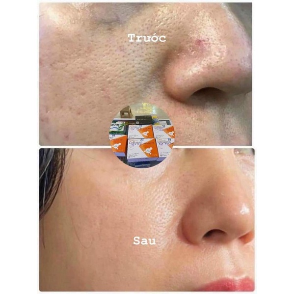 GPH Up Derma COLLAGEN - Collagen thủy phân - Hết khô hạn - Da căng bóng đàn hồi - Tóc chắc mượt - Xương chắc khỏe