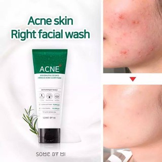 Sữa rửa mặt some by mi aha-bha-pha 30 days miracel acne clear foam 100ml